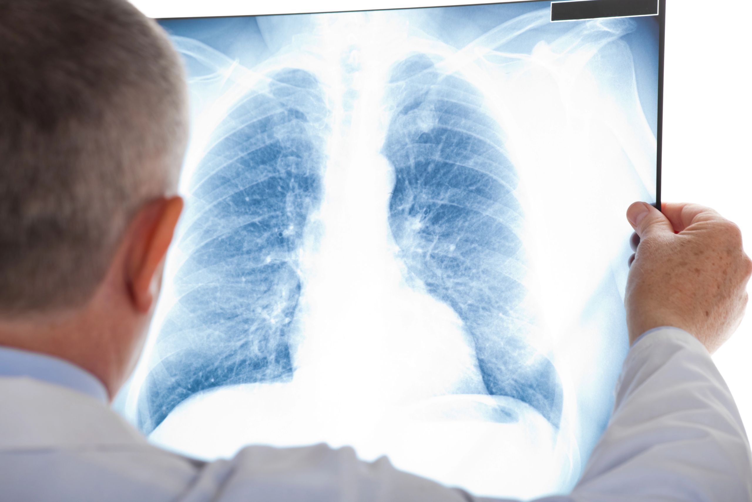 The Importance of Disability Benefits Questionnaires (DBQs)