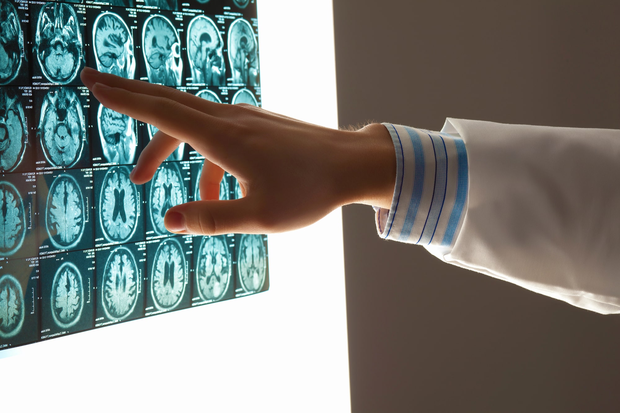 Traumatic Brain Injury (TBI)